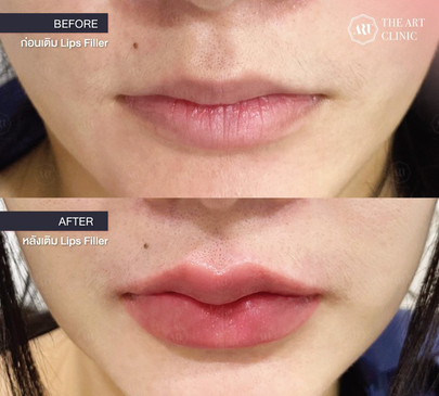 Slider image (8) The Art Clinic